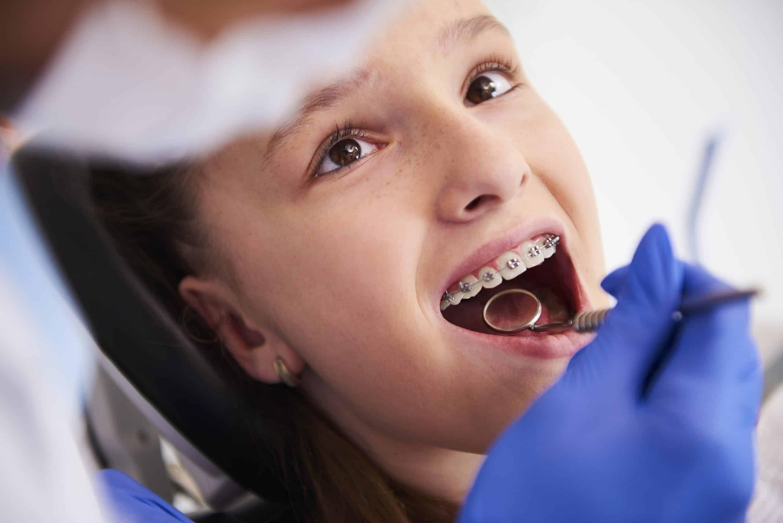 Antalya Kliniğinde Çocuklar İçin Kişiye Özel Ortodontik Çözüm Planları