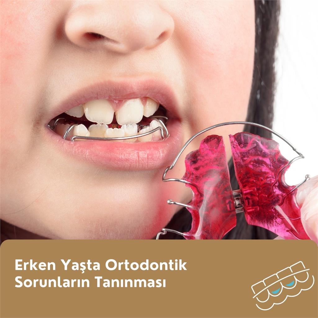 Çocuklarda Ortodontik Sorunların Erken Belirlenmesi ve Tanı Yöntemleri