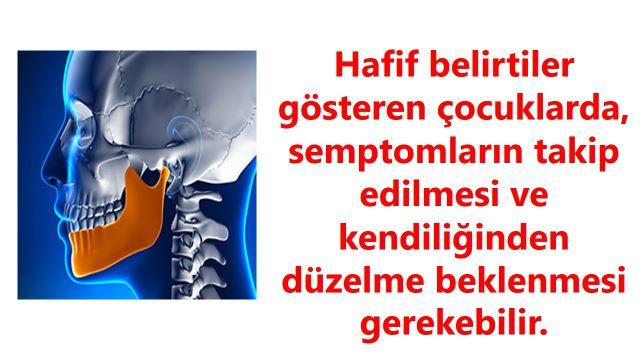 Temporomandibular Eklem Problemlerinin Çocuklarda Görülme Sıklığı ve Temel Nedenleri