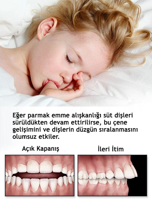 Ailelere Parmak Emme Alışkanlığıyla Baş Etme Konusunda Öneriler