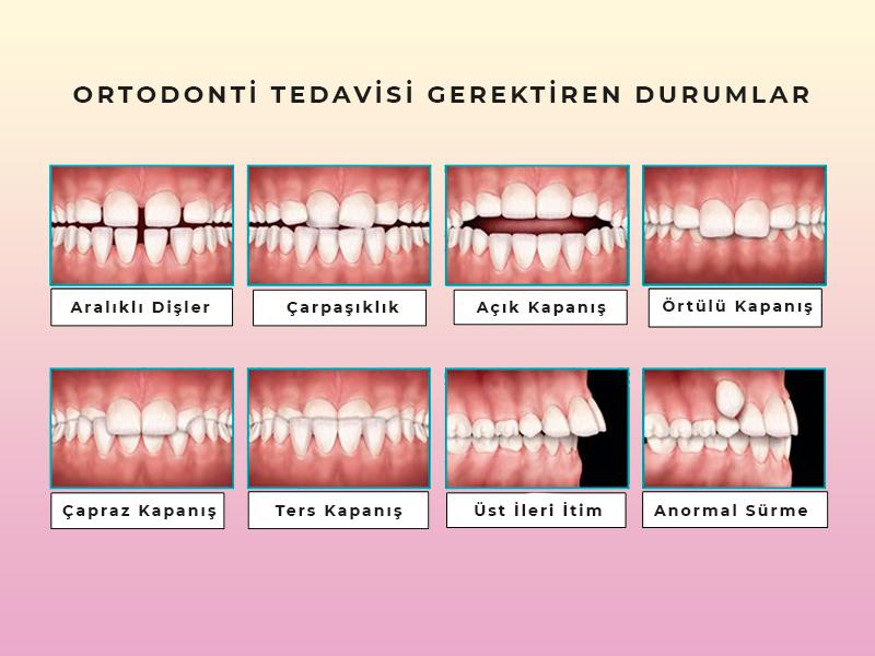Ortodontik Tedavi Sonrası Diş ve Diş Eti Sağlığının İzlenmesi