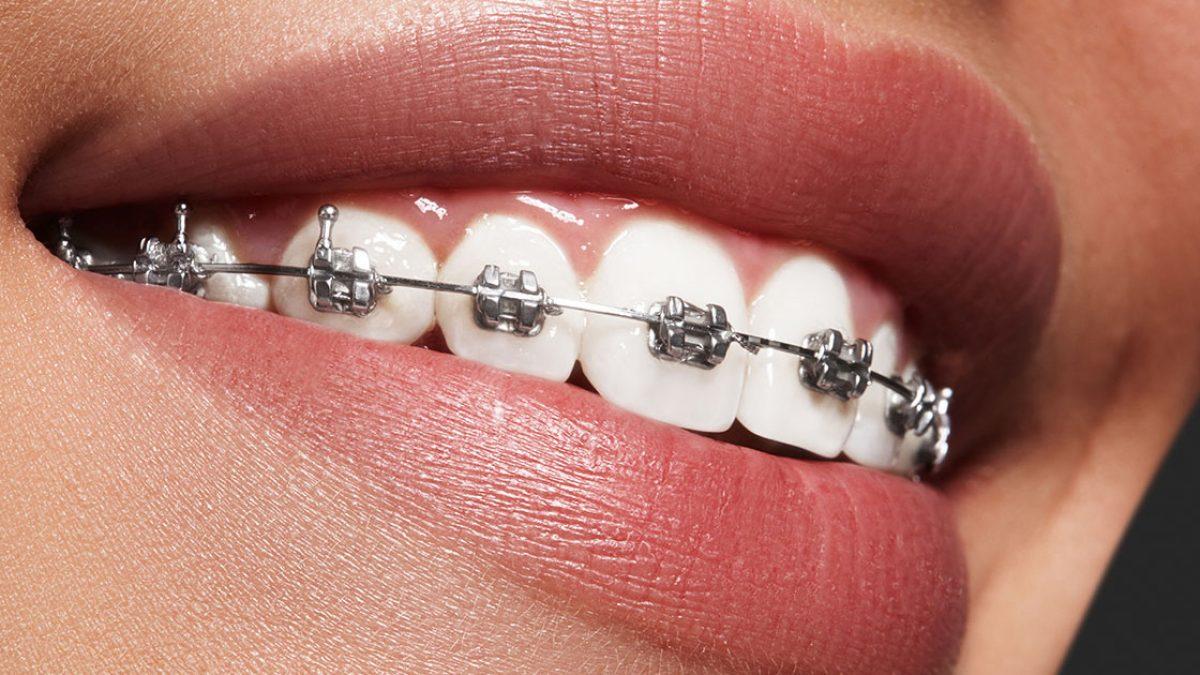 Tedaviye Başlama Öncesinde Ebeveynlerin Rolü ve Sorumlulukları