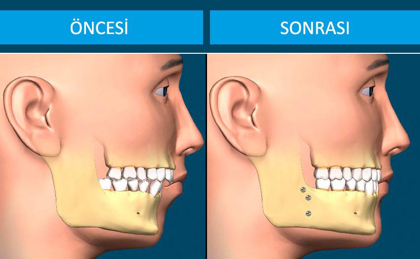 Çocuklarda ve Gençlerde Destekleyici Aile ve Uzman Yaklaşımları