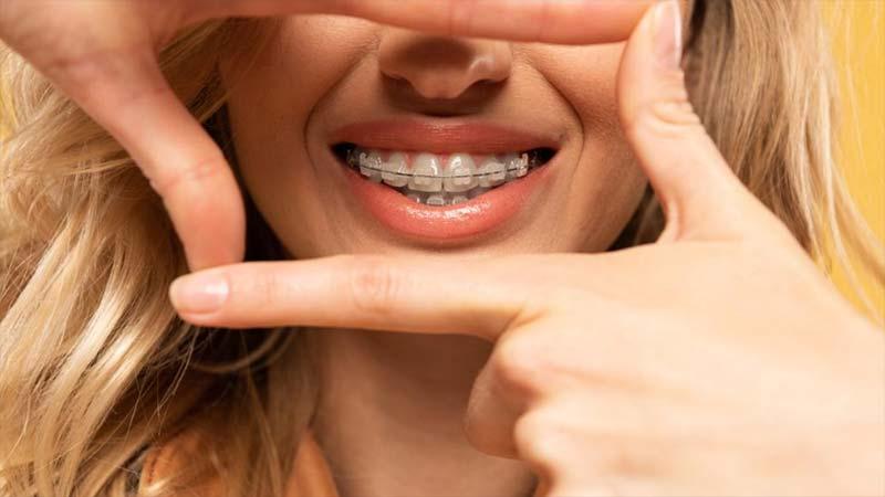 Ortodontist Kontrollerinde Hijyen Değerlendirmesi ve Öneriler