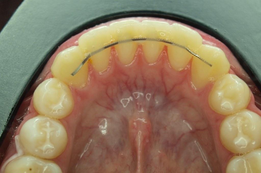 Düzenli Kontrollerin Retansiyon Başarısındaki Rolü