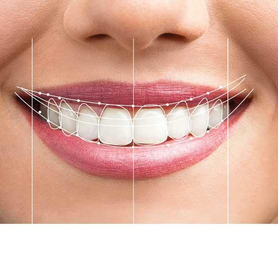 Kişiye Özel Gülüş Tasarımı İçin Antalya Diş Hekimi Seçim Kriterleri