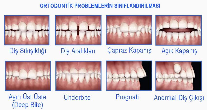 Ortodontik Problemlerin Psikososyal Etkileri ve Özgüven Üzerindeki Rolü
